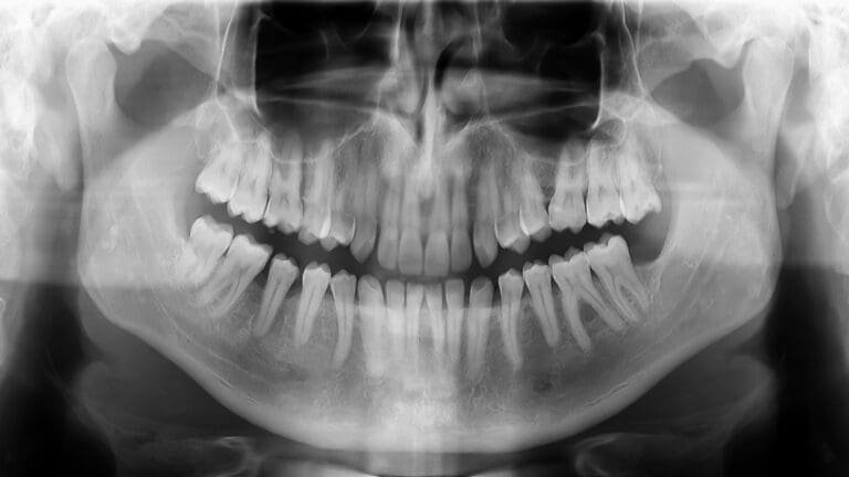Bone Crunching for Beauty – The Weird Side of the internet